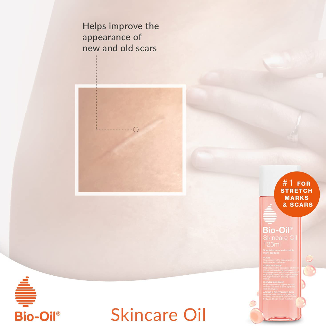 Bio-Oil Skincare Oil Improve the Appearance of Scars Stretch Marks and Skin Tone Bio-Oil Skincare Oil Improve the Appearance of Scars Stretch Marks and Skin Tone